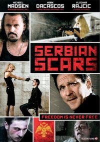 nf 283 Serbian scars (DVD) beg